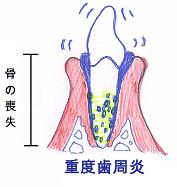 メインテナンスの重要性1