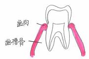 歯周病