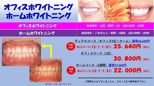 間もなくホワイトニングキャンペーン開始
