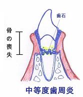 動揺度